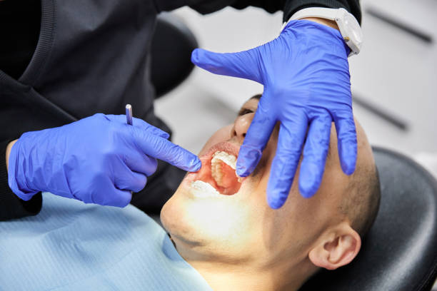 Best Emergency Gum Treatment in Staffd, OR